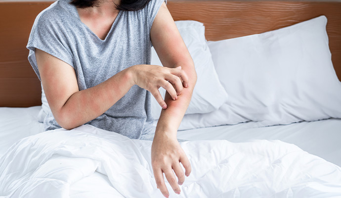 Allergic skin reaction